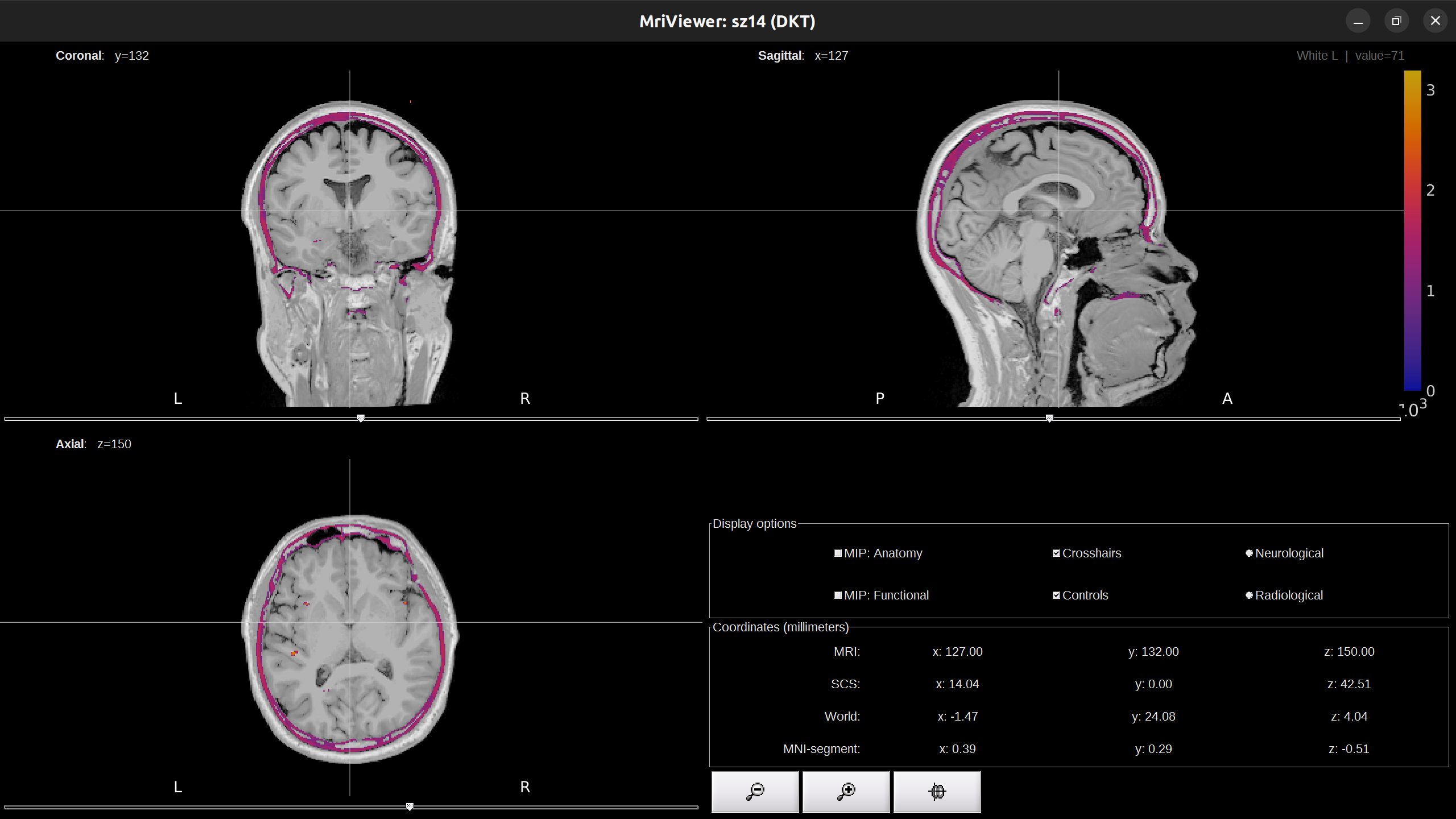 coreged_ct_mri