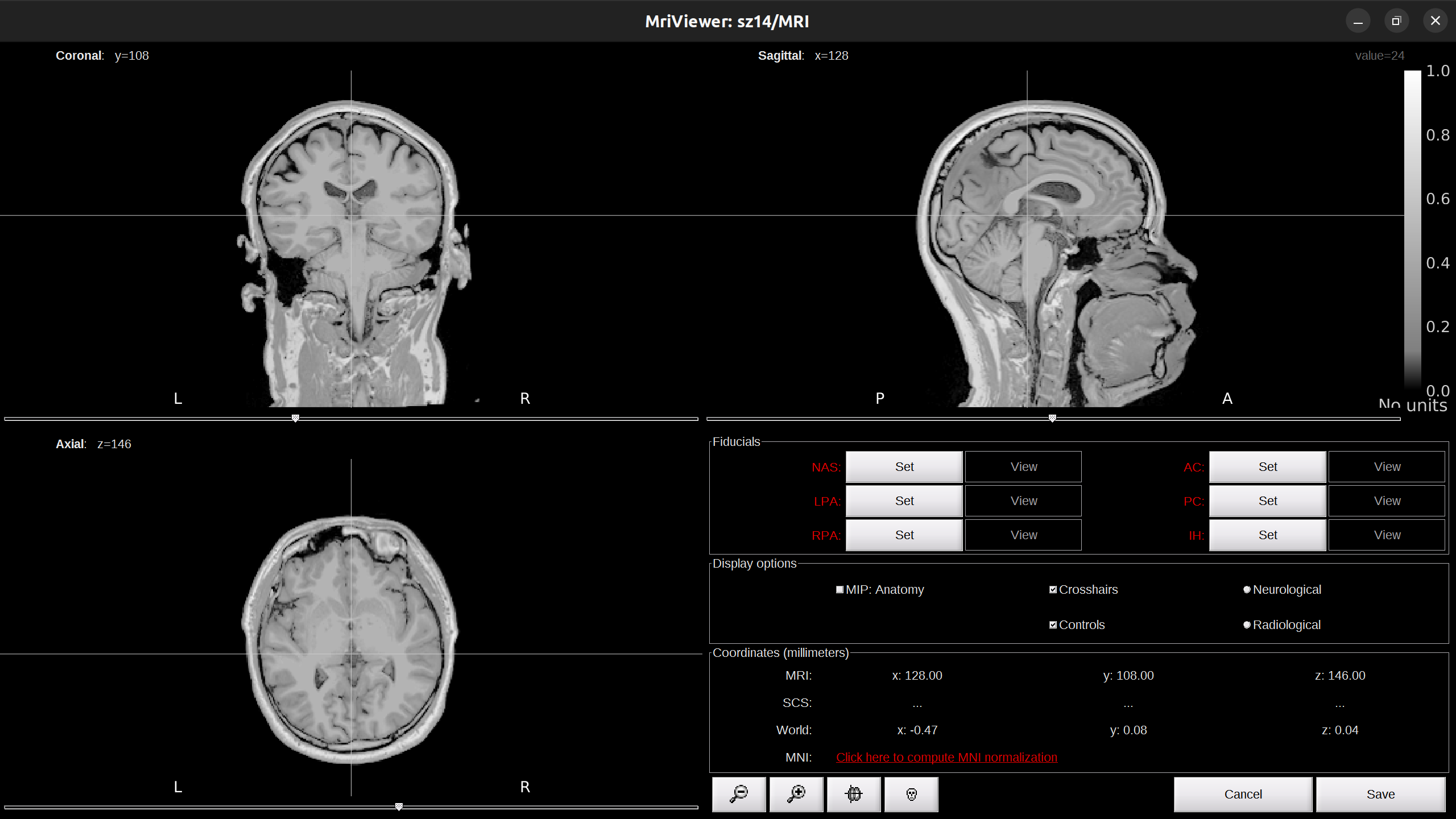 mri_viewer