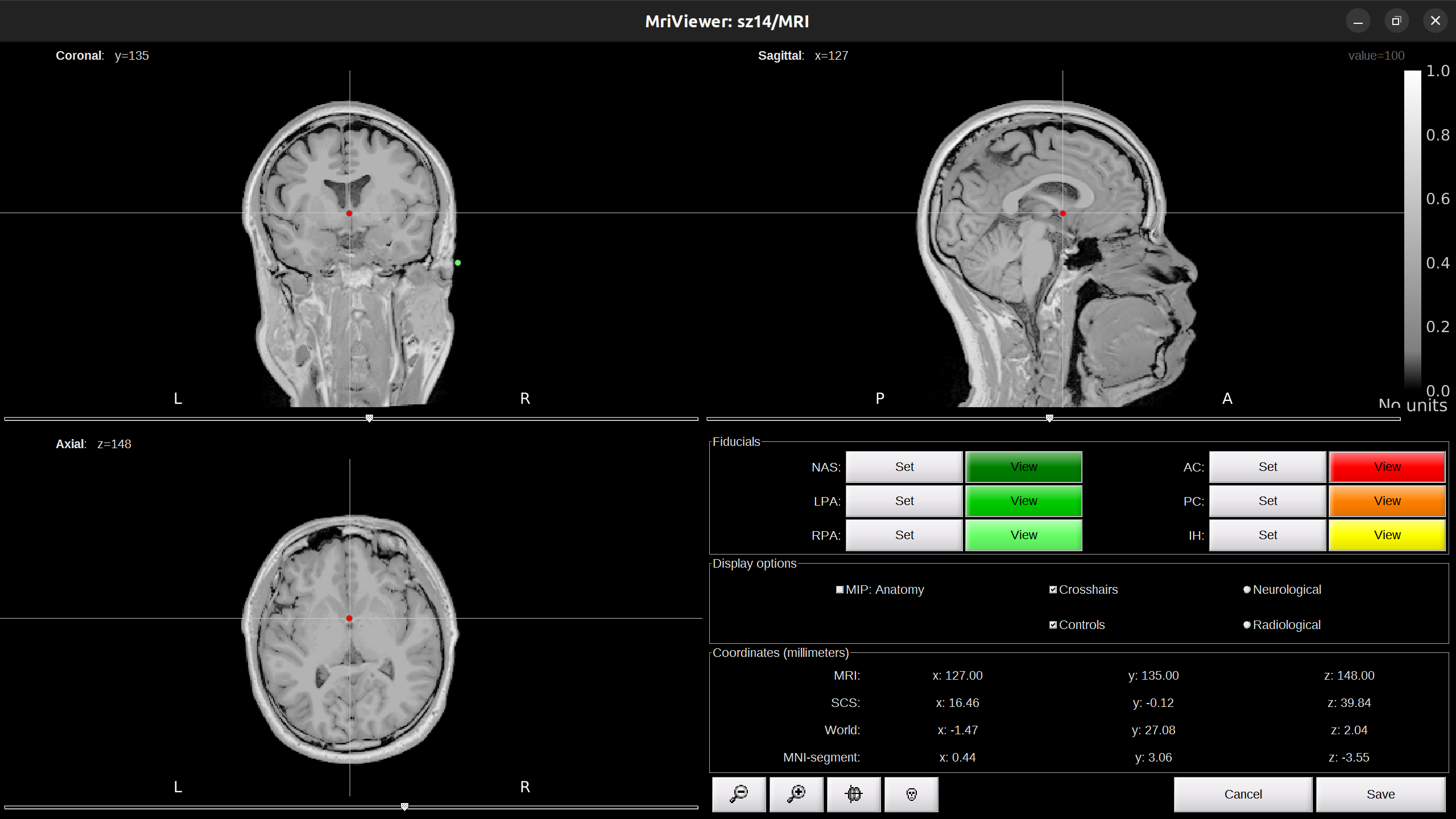 mri_viewer2